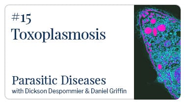 Toxoplasmosis