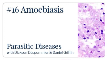 Amoebiasis