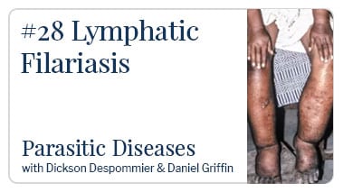 Lymphatic Filariasis
