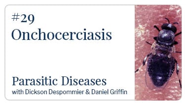 Onchocercaiasis