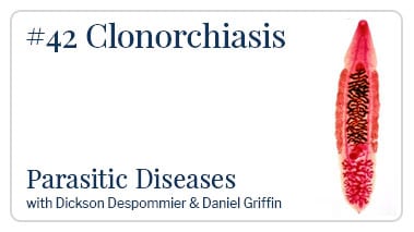 Clonorchiasis