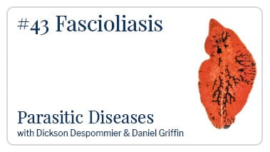 Fascioliasis