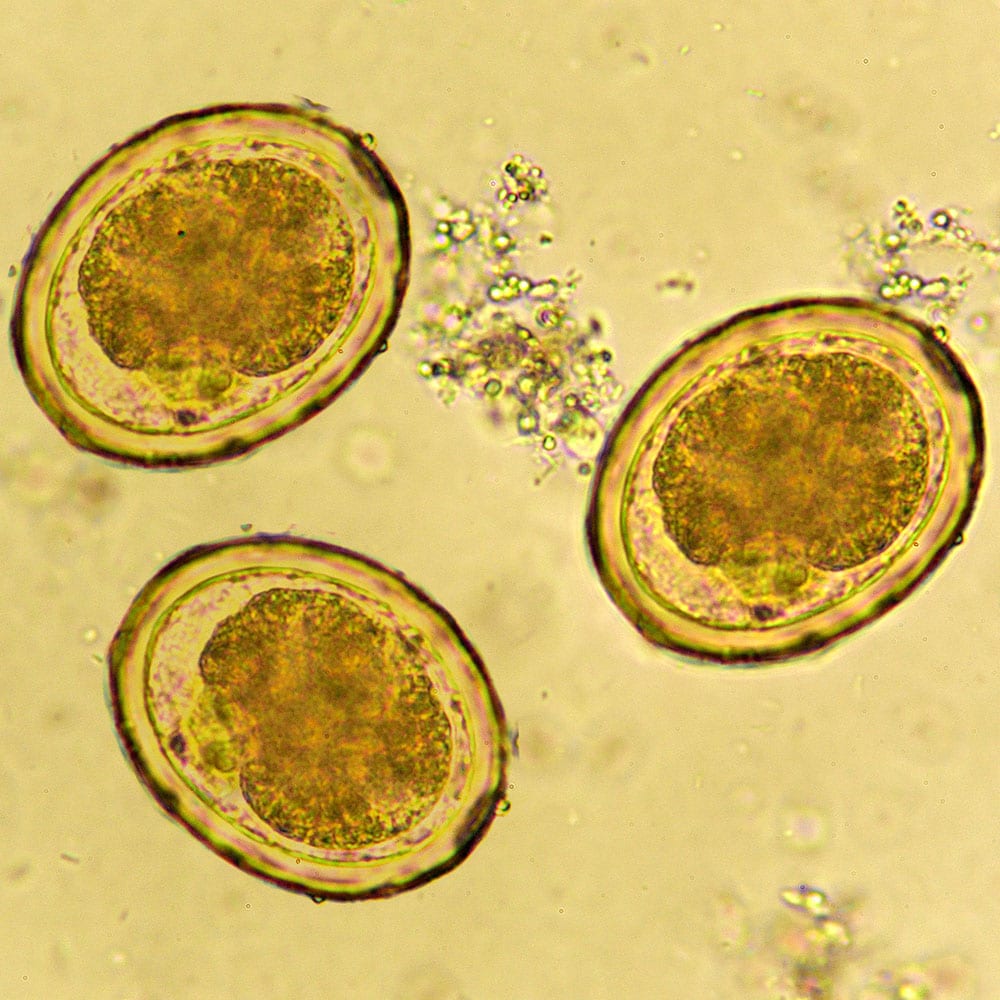 Eggs of Ascaris lumbricoides roundworm in stool
