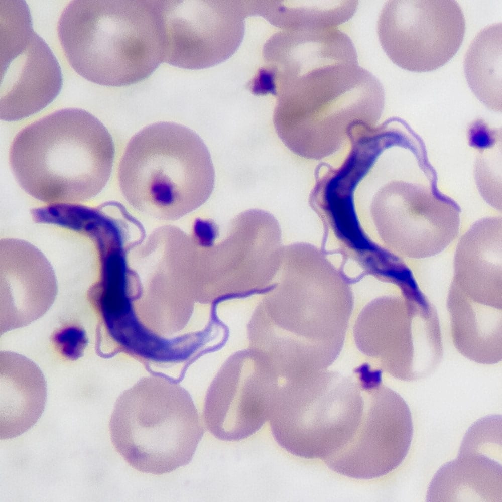 Trypanosoma gambiense blood smear