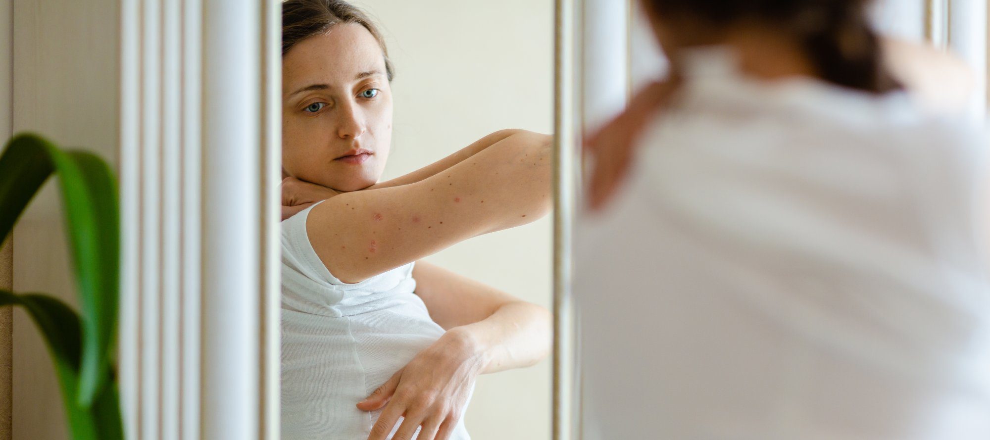 Woman looks to an itching rash