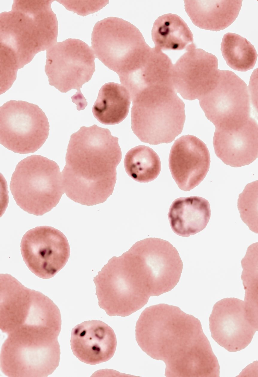 FIGURE 2. Legend: Blood smear showing Babesia spp