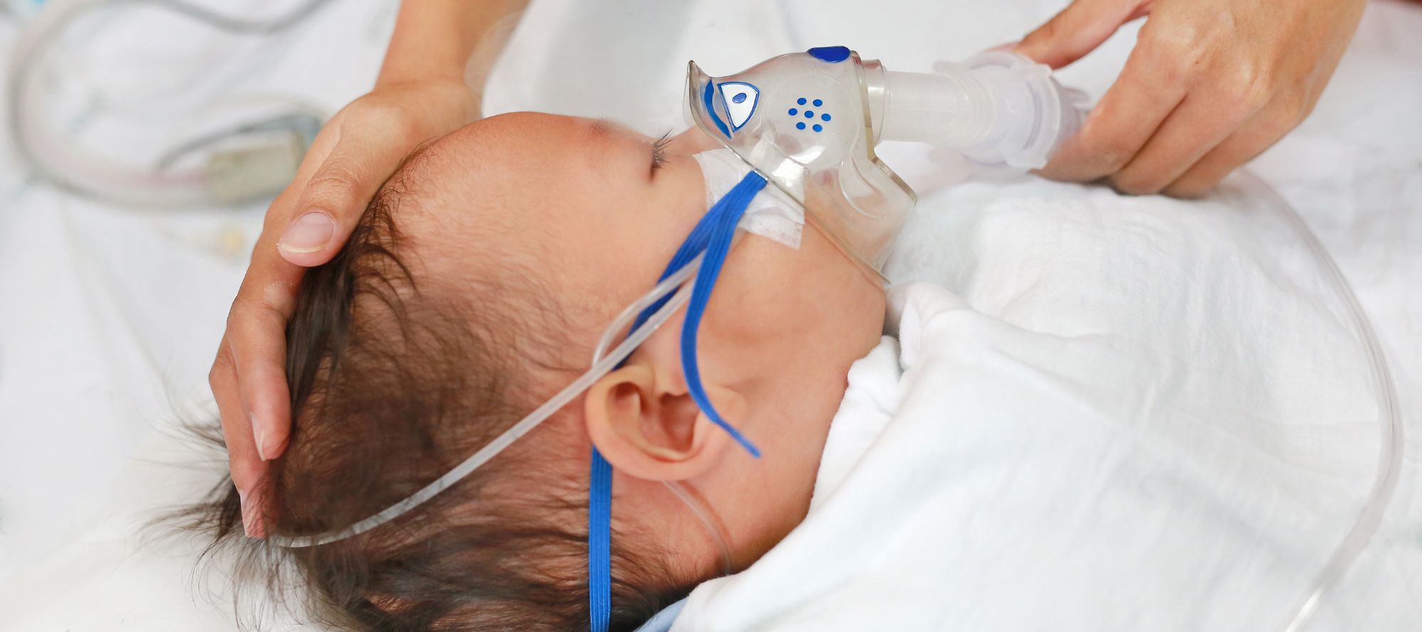 Baby with albuterol mask on taking treatment