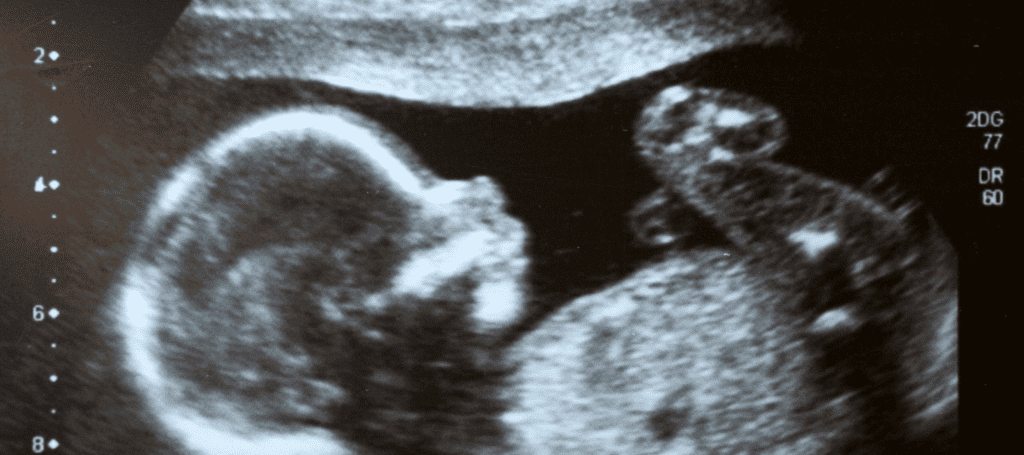 Pregnant